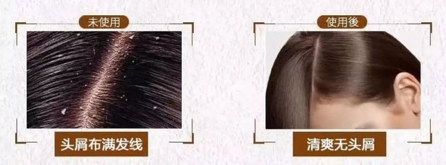 脫發、掉發、頭發稀少？用它洗洗，一次就離不開